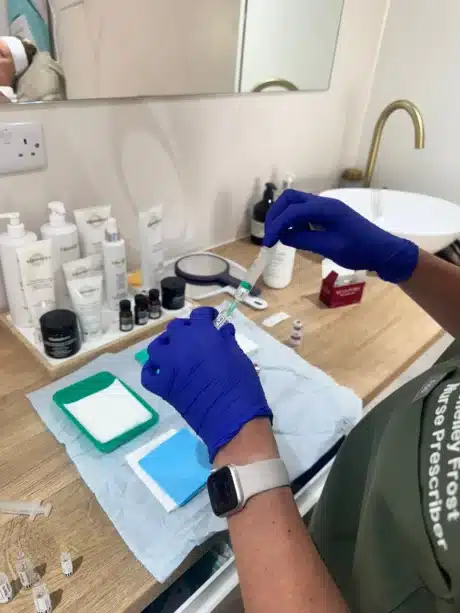 Sculptra Treatments prep